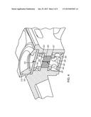 VENTED REFILL ARRANGEMENT FOR IMPLANTABLE DRUG-DELIVERY DEVICES diagram and image