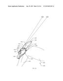 IMPLANTABLE DYNAMIC APPARATUS HAVING AN ANTI JAMMING FEATURE diagram and image