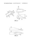 Cochlear Implant Electrode Insertion Support Device diagram and image