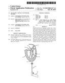 TRANSAPICAL MITRAL VALVE REPAIR METHOD diagram and image