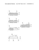 TRANSAPICAL MITRAL VALVE REPAIR METHOD diagram and image