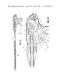 ENDOSCOPIC SURGICAL CLIP APPLIER diagram and image