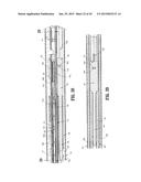 ENDOSCOPIC SURGICAL CLIP APPLIER diagram and image