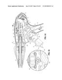 ENDOSCOPIC SURGICAL CLIP APPLIER diagram and image