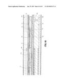 ENDOSCOPIC SURGICAL CLIP APPLIER diagram and image