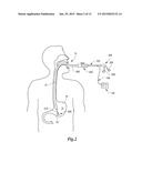 TISSUE APPOSITION CLIP APPLICATION METHODS diagram and image