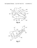 TISSUE APPOSITION CLIP APPLICATION METHODS diagram and image