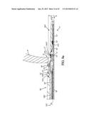 SYSTEM FOR PERFORMING ANASTOMOSIS BETWEEN AN ORGANIC WALL AND AN ORGANIC     CONDUIT diagram and image