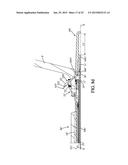 SYSTEM FOR PERFORMING ANASTOMOSIS BETWEEN AN ORGANIC WALL AND AN ORGANIC     CONDUIT diagram and image