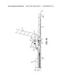 SYSTEM FOR PERFORMING ANASTOMOSIS BETWEEN AN ORGANIC WALL AND AN ORGANIC     CONDUIT diagram and image