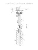 SYSTEM FOR PERFORMING ANASTOMOSIS BETWEEN AN ORGANIC WALL AND AN ORGANIC     CONDUIT diagram and image