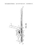 SYSTEM FOR PERFORMING ANASTOMOSIS BETWEEN AN ORGANIC WALL AND AN ORGANIC     CONDUIT diagram and image