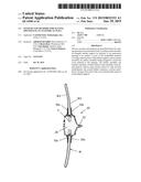 SYSTEMS AND METHODS FOR SEALING OPENINGS IN AN ANATOMICAL WALL diagram and image