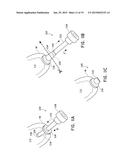 SYSTEMS AND METHODS FOR SEALING OPENINGS IN AN ANATOMICAL WALL diagram and image