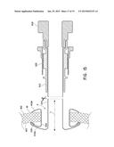 SYSTEMS AND METHODS FOR SEALING OPENINGS IN AN ANATOMICAL WALL diagram and image