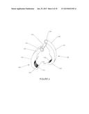 Percutaneous Pedicle Screw Revision System diagram and image