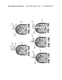 Methods for Performing Invasive Medical Procedures Using a Surgical Robot diagram and image