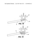 Methods for Performing Invasive Medical Procedures Using a Surgical Robot diagram and image