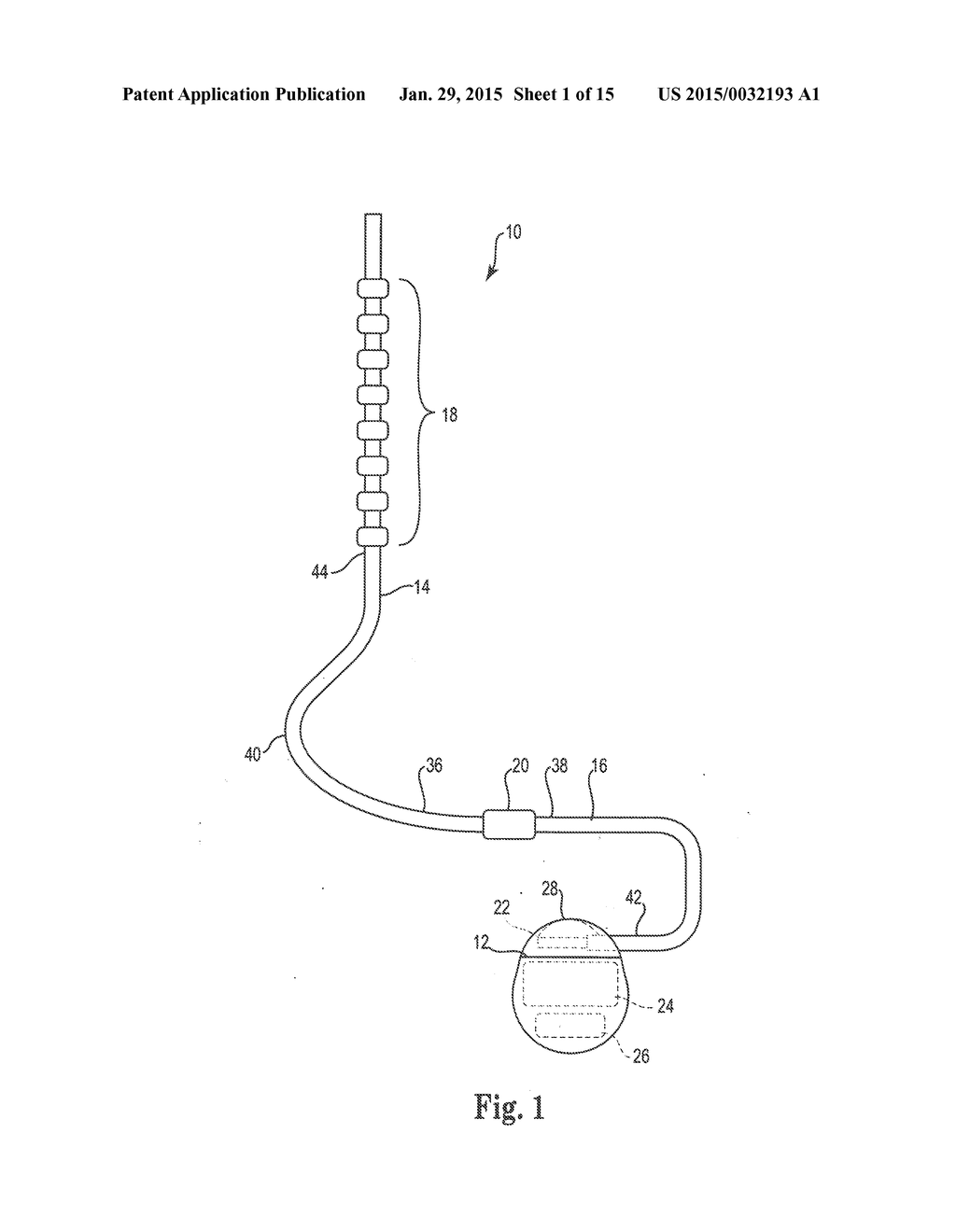 LOW INSERTION FORCE ELECTRICAL CONNECTOR FOR IMPLANTABLE MEDICAL DEVICES - diagram, schematic, and image 02