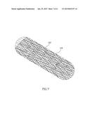 CAROTID STENT ASSEMBLY AND METHODS FOR TREATMENT VIA BODY LUMENS diagram and image