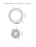 CAROTID STENT ASSEMBLY AND METHODS FOR TREATMENT VIA BODY LUMENS diagram and image