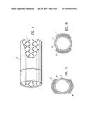 NON-THROMBOGENIC STENT JACKET diagram and image