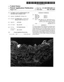 FLEXIBLE VASCULAR PROSTHESIS, AND METHOD FOR ITS PRODUCTION diagram and image