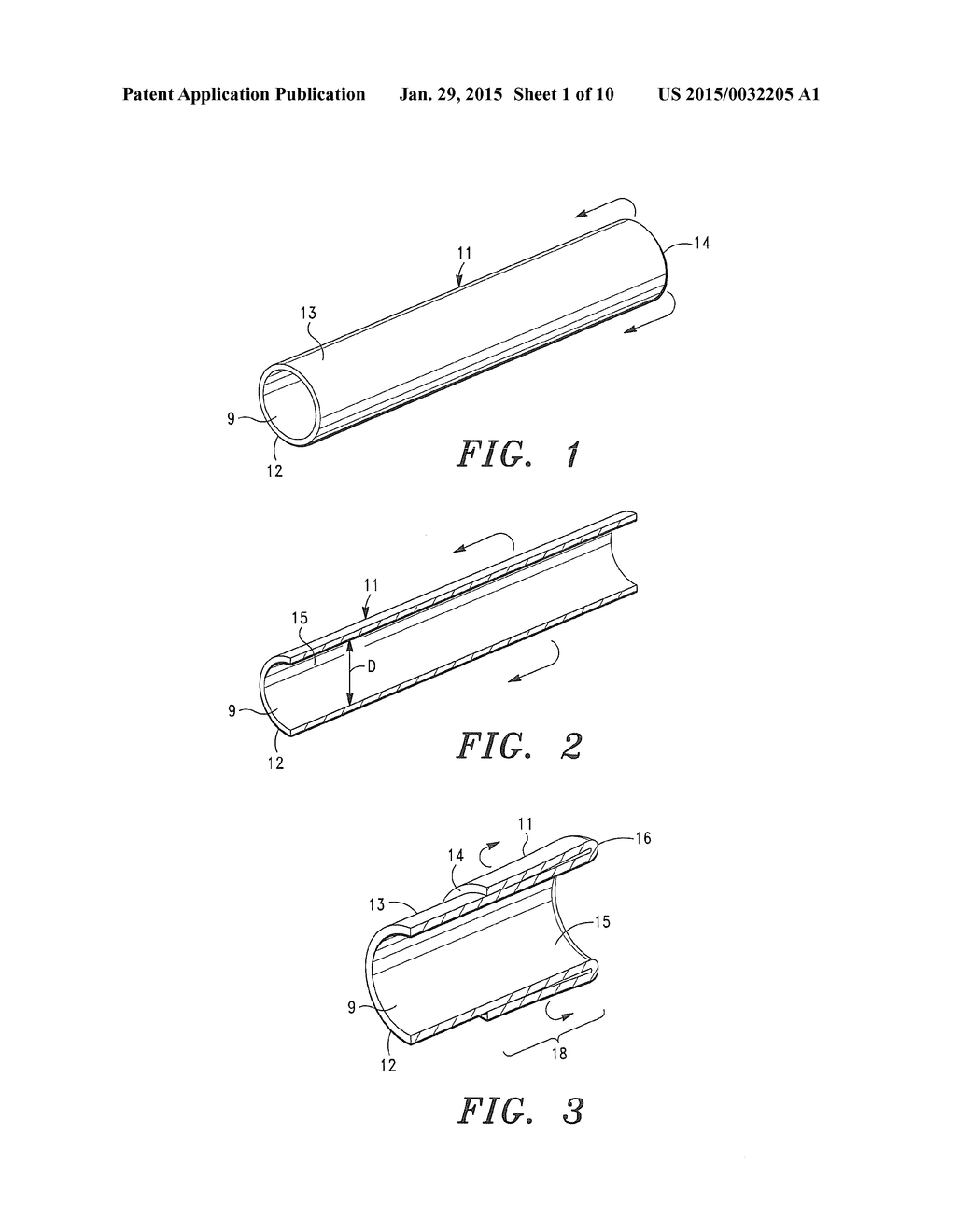 Seamless Tubular Extracellular Matrix Prosthetic Valve and Method for     Forming Same - diagram, schematic, and image 02