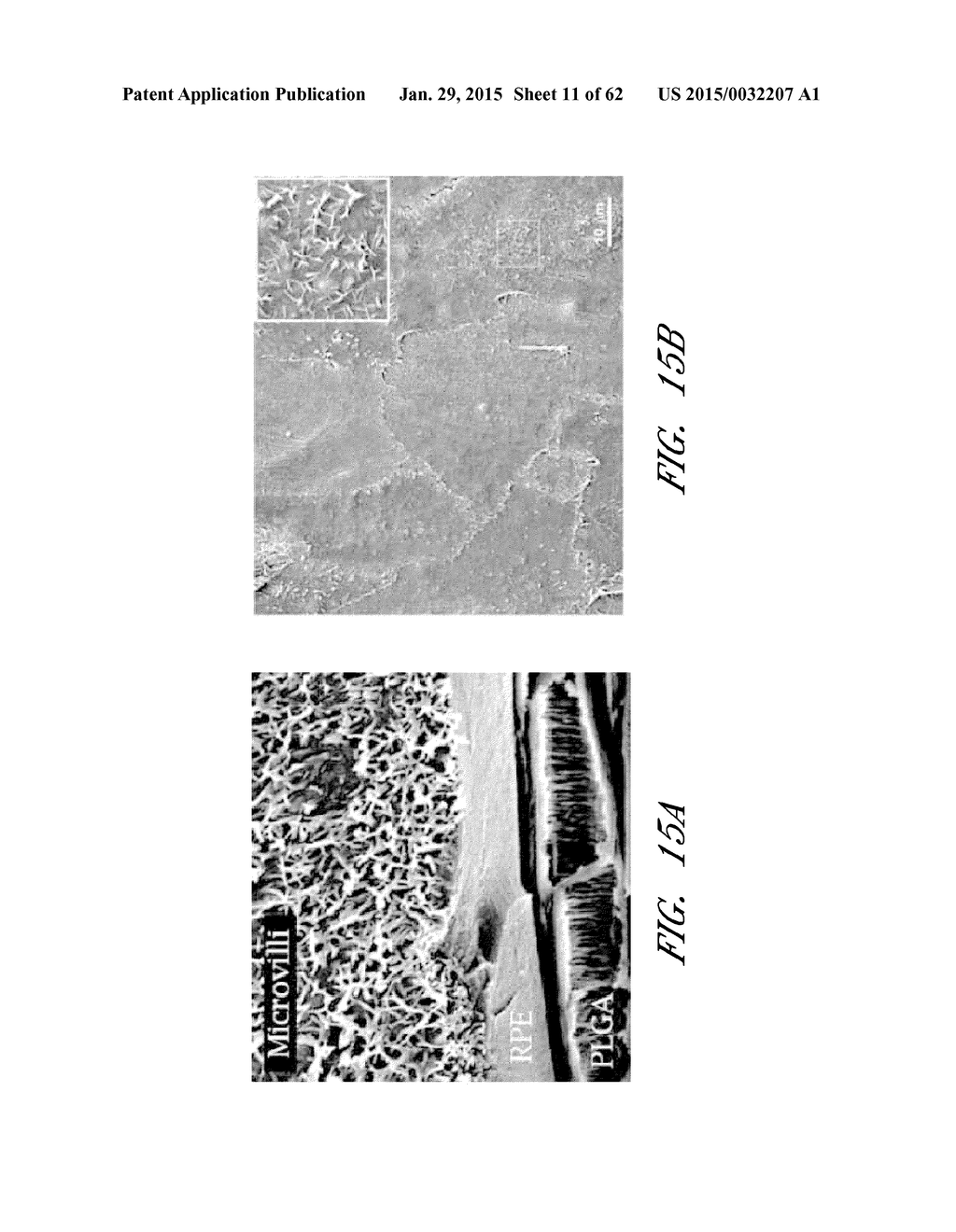 INSTRUMENTS AND METHODS FOR THE IMPLANTATION OF CELL-SEEDED SUBSTRATES - diagram, schematic, and image 12