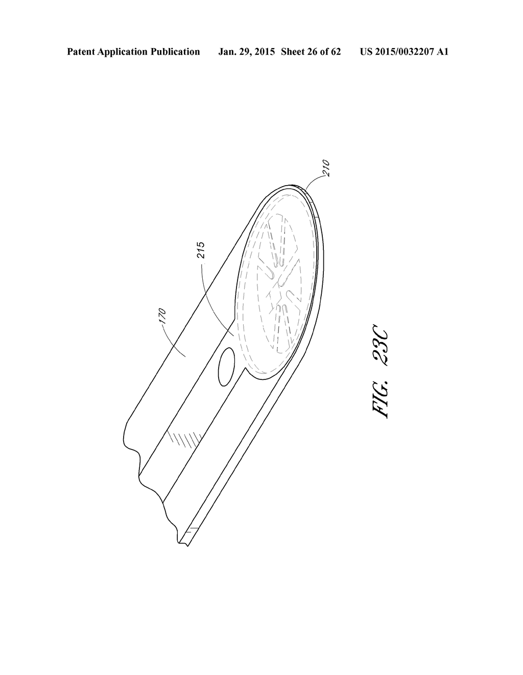 INSTRUMENTS AND METHODS FOR THE IMPLANTATION OF CELL-SEEDED SUBSTRATES - diagram, schematic, and image 27