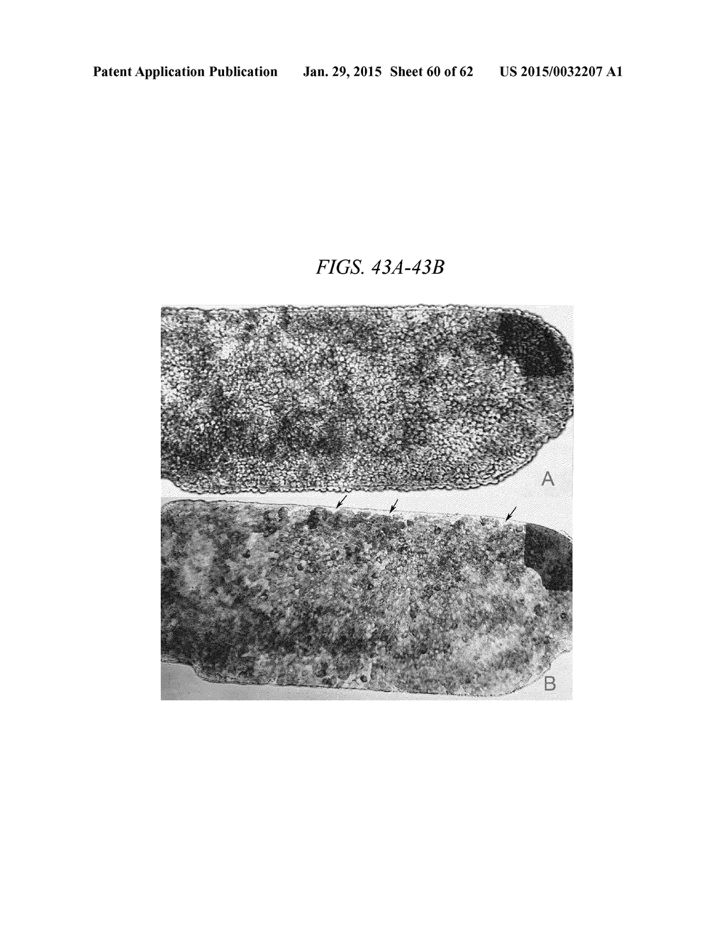 INSTRUMENTS AND METHODS FOR THE IMPLANTATION OF CELL-SEEDED SUBSTRATES - diagram, schematic, and image 61