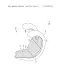 COMPLIANT ANTI-RESORPTION IMPLANT diagram and image