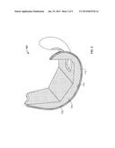 COMPLIANT ANTI-RESORPTION IMPLANT diagram and image