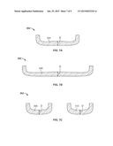 COMPLIANT ANTI-RESORPTION IMPLANT diagram and image