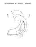 COMPLIANT ANTI-RESORPTION IMPLANT diagram and image