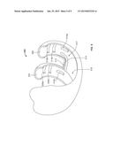 COMPLIANT ANTI-RESORPTION IMPLANT diagram and image