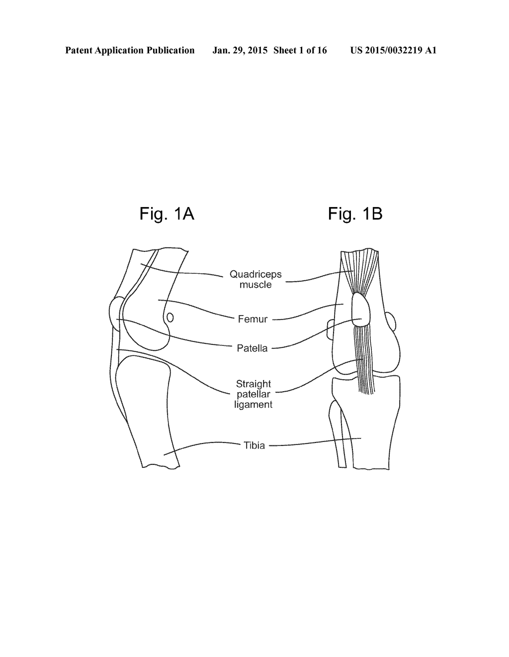 Prosthetic Devices and Implants - diagram, schematic, and image 02