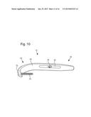 Prosthetic Devices and Implants diagram and image