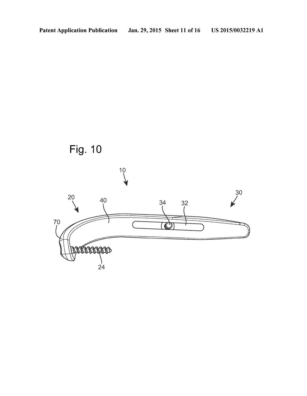 Prosthetic Devices and Implants - diagram, schematic, and image 12