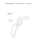 Prosthetic Devices and Implants diagram and image