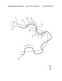 WORKING APPARATUS FOR A LIMITED AREA diagram and image