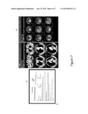 METHOD AND COMPUTING SYSTEM FOR PROVIDING AN INTERFACE BETWEEN AN IMAGING     SYSTEM AND A REPORTING SYSTEM diagram and image