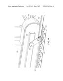 CLEAT ANCHORING SYSTEM USEFUL ON HDD RIGS diagram and image