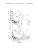 Ventilation Mask with Integrated Piloted Exhalation Valve diagram and image