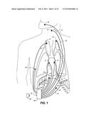 THERAPEUTIC DIAPHRAGM STIMULATION DEVICE AND METHOD diagram and image