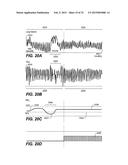 THERAPEUTIC DIAPHRAGM STIMULATION DEVICE AND METHOD diagram and image