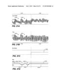 THERAPEUTIC DIAPHRAGM STIMULATION DEVICE AND METHOD diagram and image