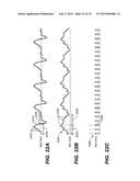 THERAPEUTIC DIAPHRAGM STIMULATION DEVICE AND METHOD diagram and image