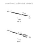 THERAPEUTIC DIAPHRAGM STIMULATION DEVICE AND METHOD diagram and image