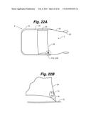 REMOVABLE BARRIER FOR PROTECTING TUNNELS AND OTHER STRUCTURES FROM     FLOODING AND OTHER HAZARDS diagram and image